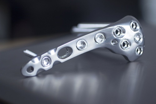 Obtaining implants for surgery could be a logistical problem