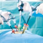 Consent for laparoscopy not valid for open surgery