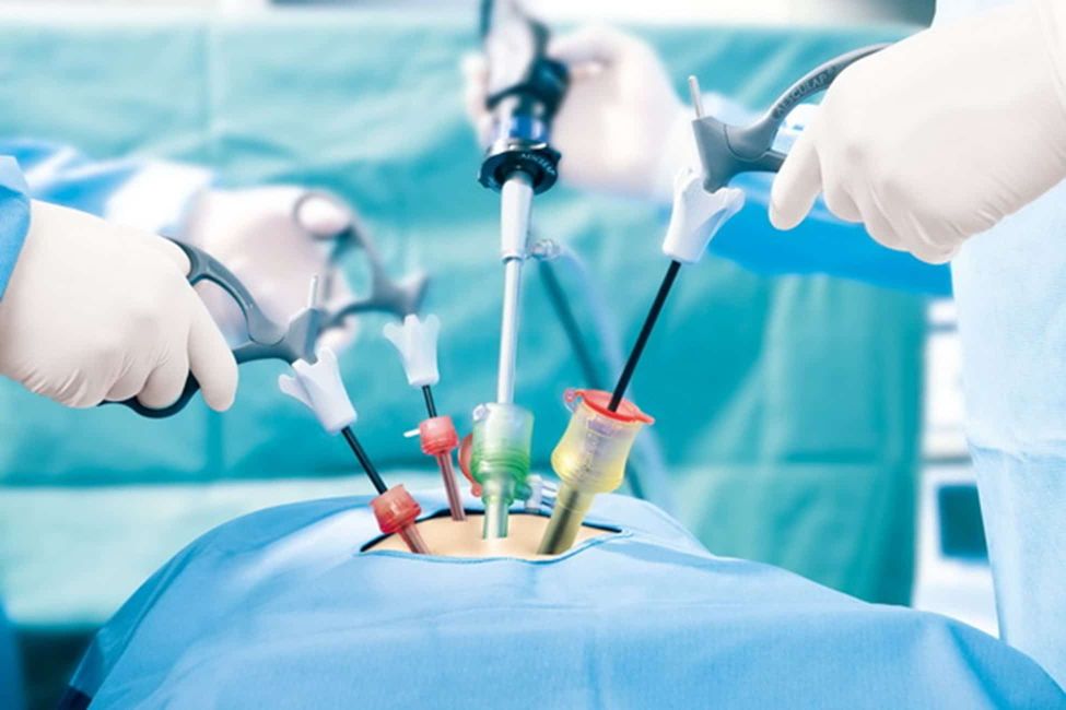 Consent for laparoscopy not valid for open surgery