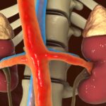 Leaving the ureter stone unturned – Doc held negligent