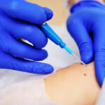 Diagnostic biopsy causes nerve loss: Court observes ‘safe procedure’ wasn’t safe enough