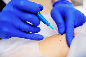 Diagnostic biopsy causes nerve loss: Court observes ‘safe procedure’ wasn’t safe enough