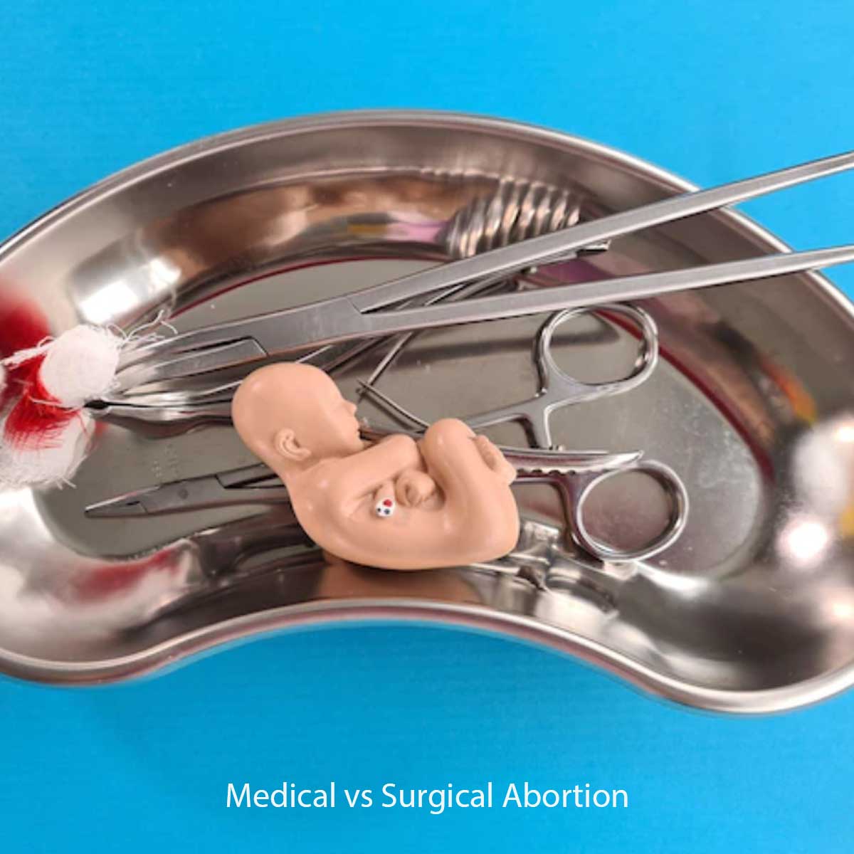 Termination without second opinion—Court flags breach of MTP Act requirement