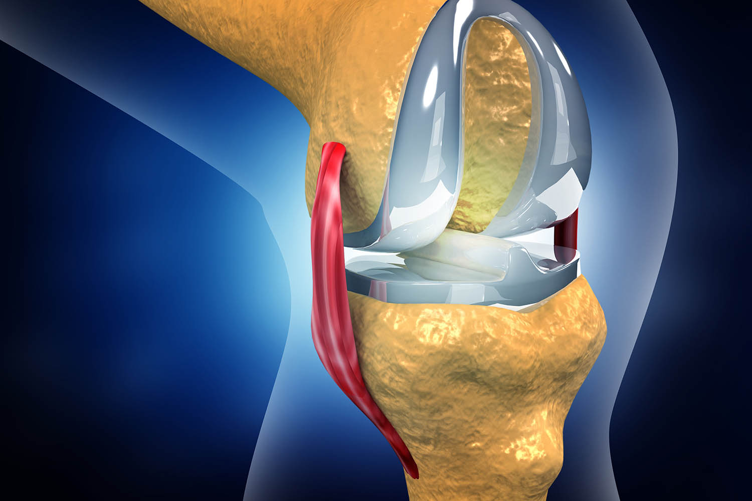 Leg lost after knee replacement — Commission finds no lapse in surgical care
