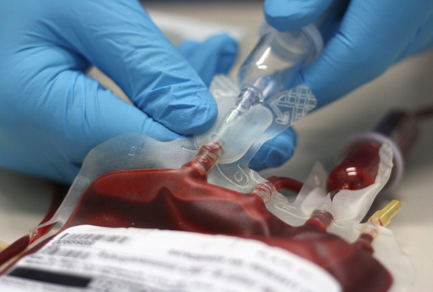 Wrong blood report confirmed as negligence