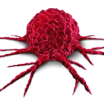 Death due to rapidly growing tumour quickly takes an ugly turn for the doctor