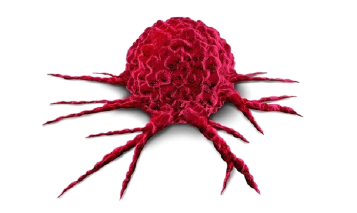 Death due to rapidly growing tumour quickly takes an ugly turn for the doctor