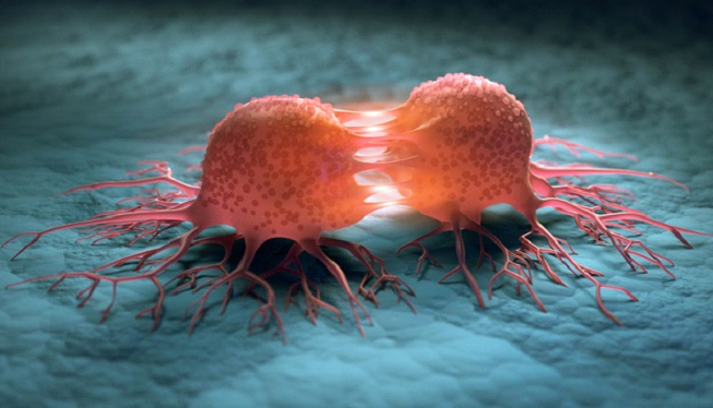 Cancer claims yet another life
