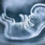 Complicated pregnancy? Complicate gynaecologist’s life!