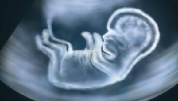 Complicated pregnancy? Complicate gynaecologist’s life!