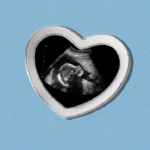 Miscarriage that was not