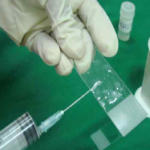 Radiologist plays pathologist at his own cost