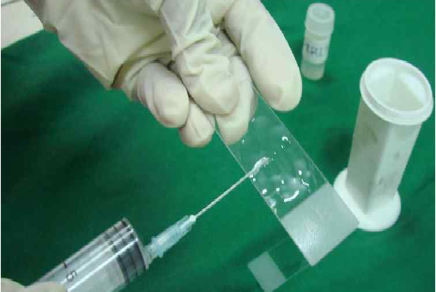 Radiologist plays pathologist at his own cost